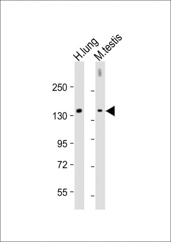 WB - c-KIT Antibody (C-term) AP7656b